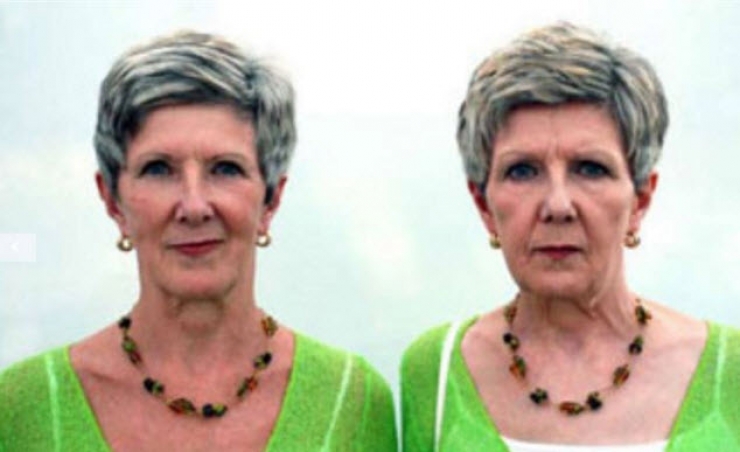 Illustration de l'article : Smokers vs. Non-smokers... These 8 pictures of twins show us that the difference is obvious!