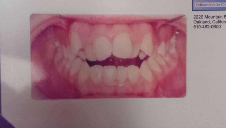 Illustration de l'article : The students at her school called her a monster... Look at what she's become!