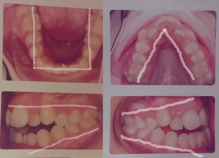 Illustration de l'article : The students at her school called her a monster... Look at what she's become!