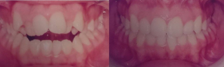 Illustration de l'article : The students at her school called her a monster... Look at what she's become!