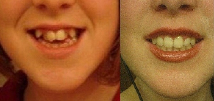 Illustration de l'article : The students at her school called her a monster... Look at what she's become!