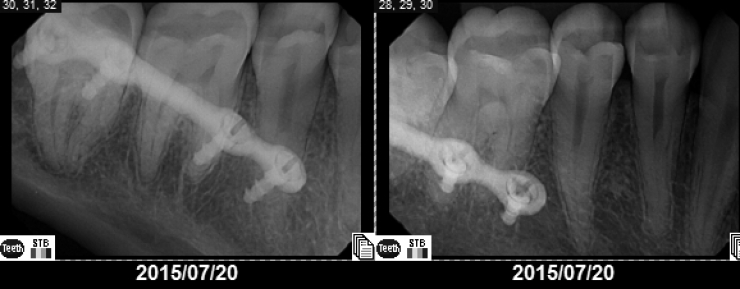 Illustration de l'article : The students at her school called her a monster... Look at what she's become!