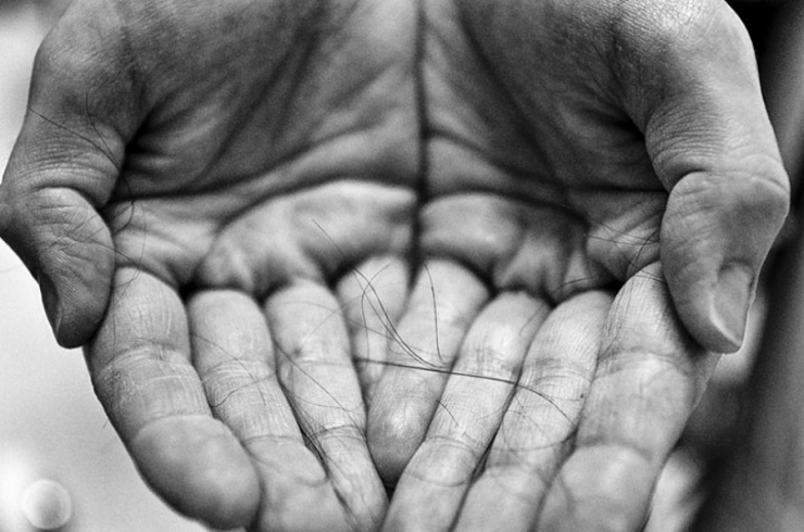 Illustration de l'article : This husband tries to sensitize the web by immortalizing the ravages cancer had on his wife...