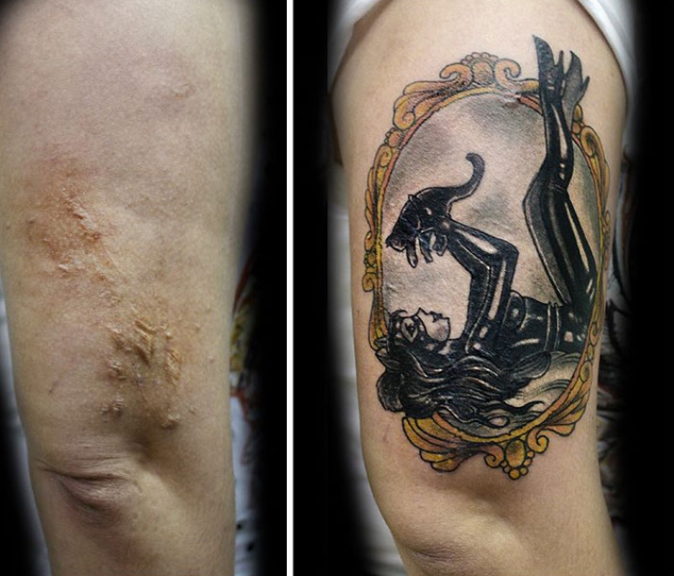 Illustration de l'article : She offers free tattoos to cover up the scars from these big life injuries