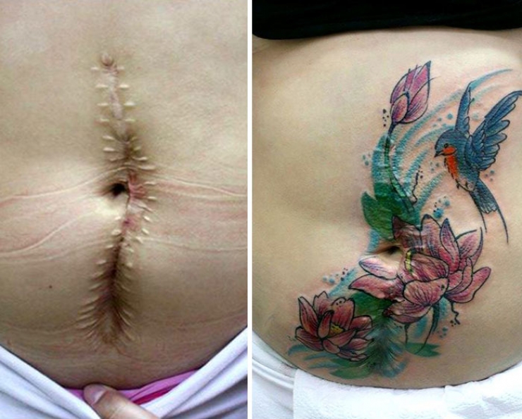 Illustration de l'article : She offers free tattoos to cover up the scars from these big life injuries