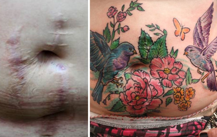 Illustration de l'article : She offers free tattoos to cover up the scars from these big life injuries