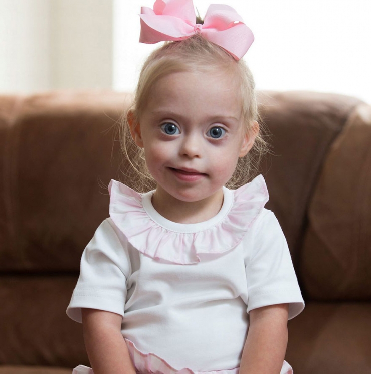 Illustration de l'article : At just two years old, ad agencies are fighting over this princess with Down's syndrome...