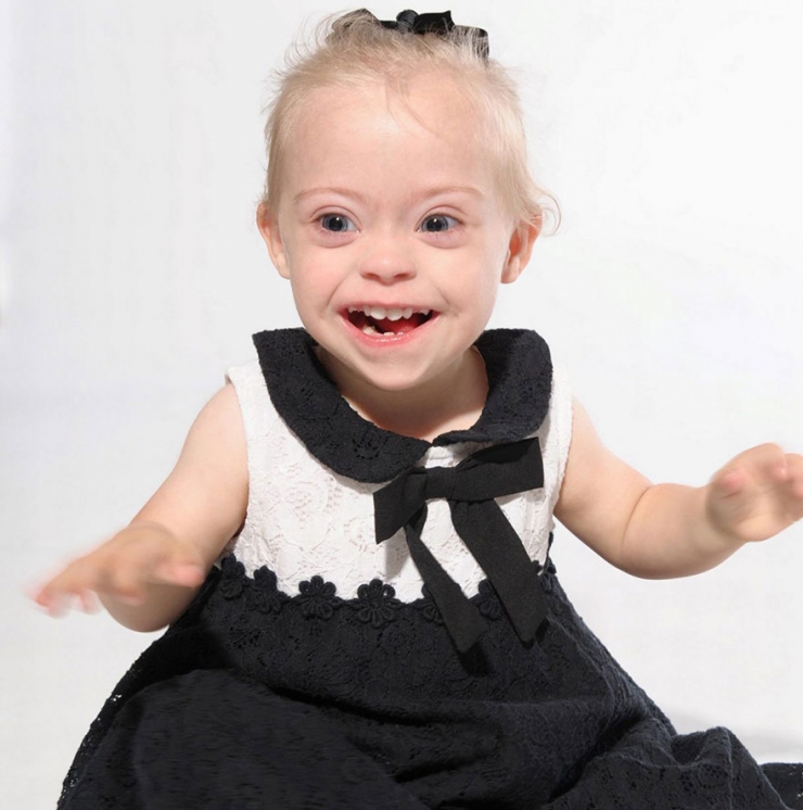Illustration de l'article : At just two years old, ad agencies are fighting over this princess with Down's syndrome...