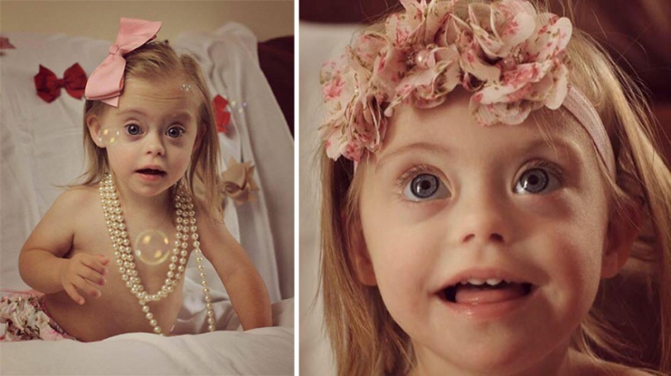 Illustration de l'article : At just two years old, ad agencies are fighting over this princess with Down's syndrome...