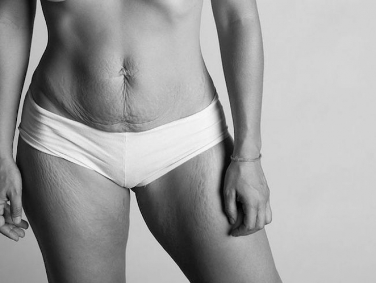 Illustration de l'article : Pictures that show how the body really looks after childbirth. All natural beauty...