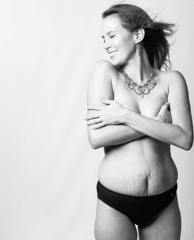 Illustration de l'article : Pictures that show how the body really looks after childbirth. All natural beauty...