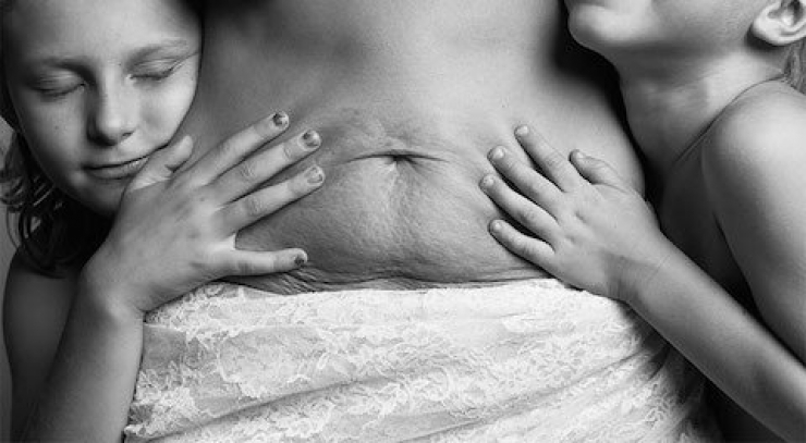 Illustration de l'article : Pictures that show how the body really looks after childbirth. All natural beauty...