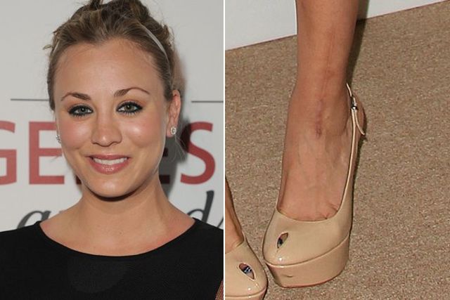 Illustration de l'article : These 15 celebrities reveal the reasons for their scars: Here are their stories!