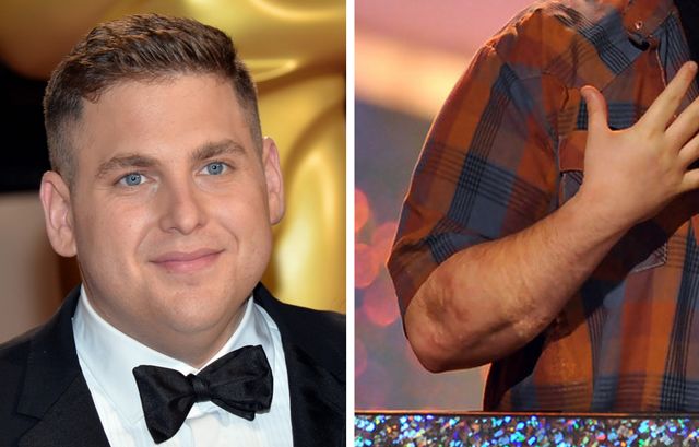 Illustration de l'article : These 15 celebrities reveal the reasons for their scars: Here are their stories!