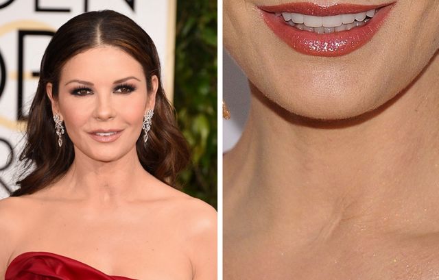 Illustration de l'article : These 15 celebrities reveal the reasons for their scars: Here are their stories!