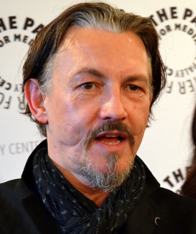 Illustration de l'article : These 15 celebrities reveal the reasons for their scars: Here are their stories!