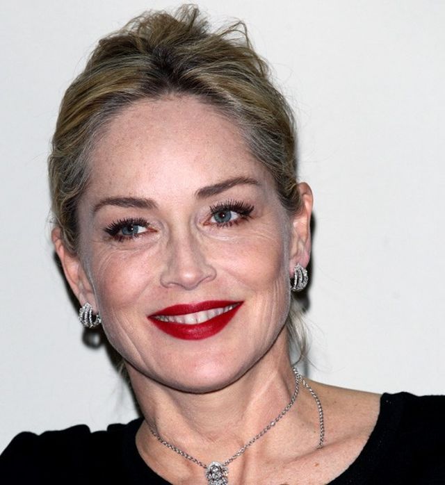 Illustration de l'article : These 15 celebrities reveal the reasons for their scars: Here are their stories!