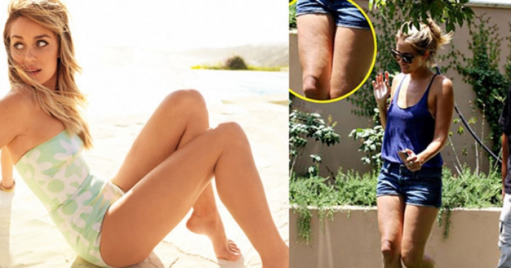 Illustration de l'article : 17 celebrities prove that no one is perfect! Bye-bye Photoshop...