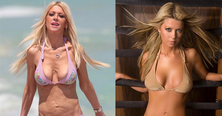 Illustration de l'article : 17 celebrities prove that no one is perfect! Bye-bye Photoshop...