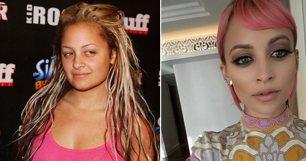 Illustration de l'article : Which of these 12 stars has changed the most physically in just a few years?