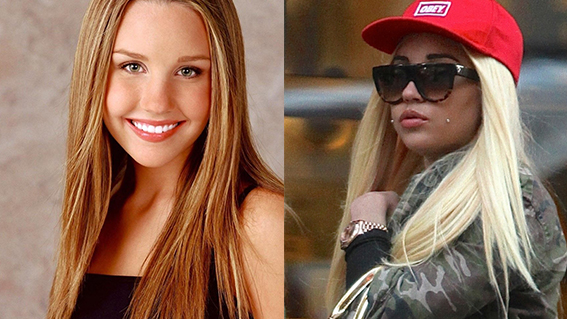 Illustration de l'article : Which of these 12 stars has changed the most physically in just a few years?