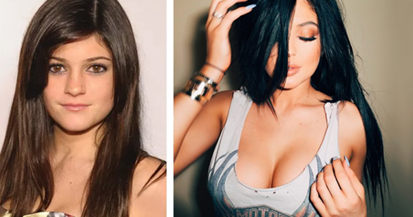 Illustration de l'article : Which of these 12 stars has changed the most physically in just a few years?