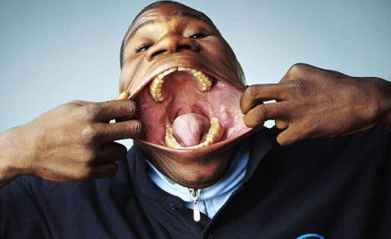 Illustration de l'article : 9 people who have really unusual body characteristics!