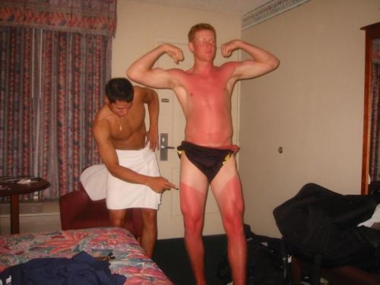 Illustration de l'article : The 24 most awkward tan lines this summer...