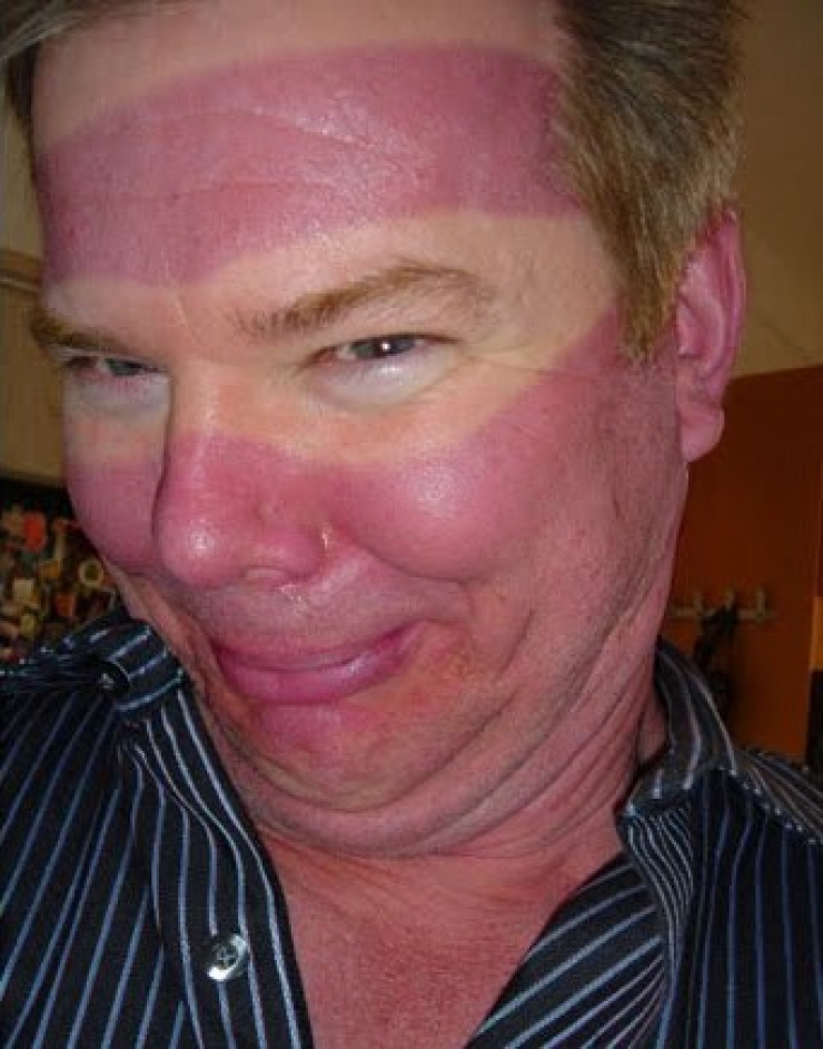 Illustration de l'article : The 24 most awkward tan lines this summer...