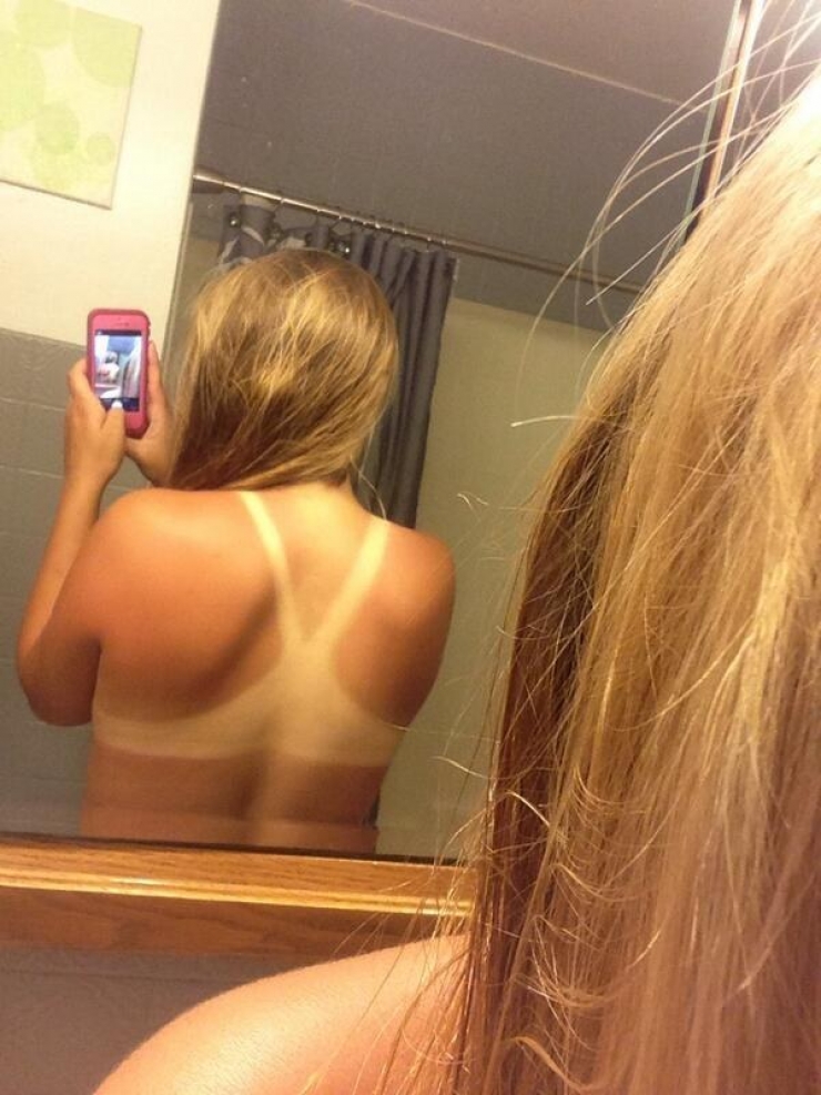 Illustration de l'article : The 24 most awkward tan lines this summer...