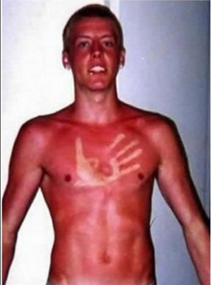 Illustration de l'article : The 24 most awkward tan lines this summer...