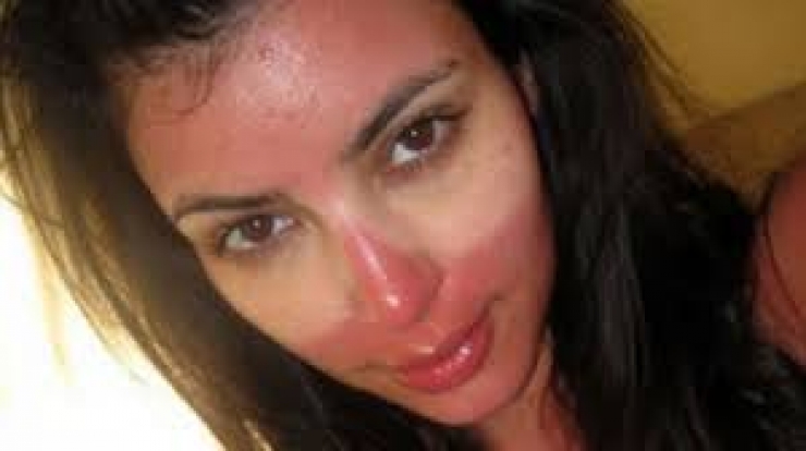 Illustration de l'article : The 24 most awkward tan lines this summer...