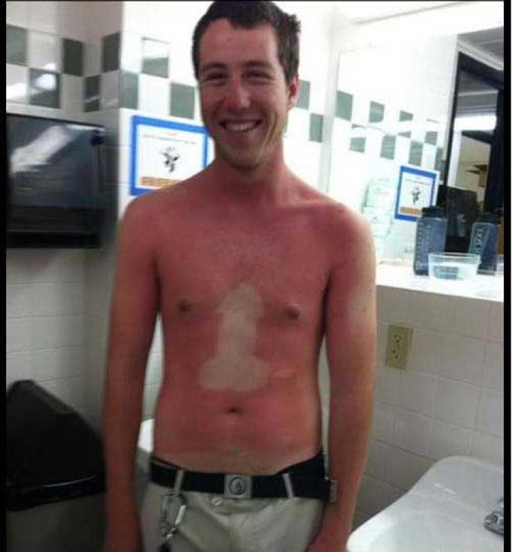 The 24 Most Awkward Tan Lines This Summer