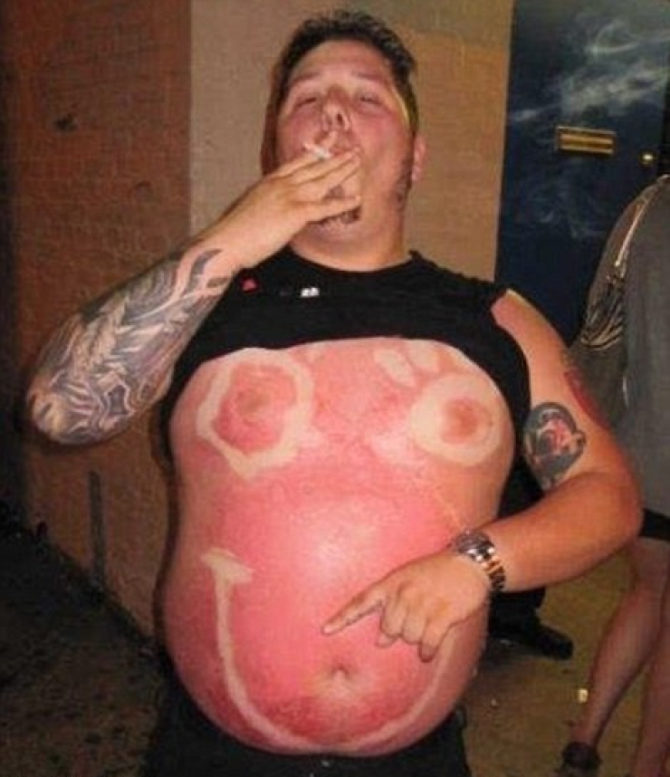 Illustration de l'article : The 24 most awkward tan lines this summer...