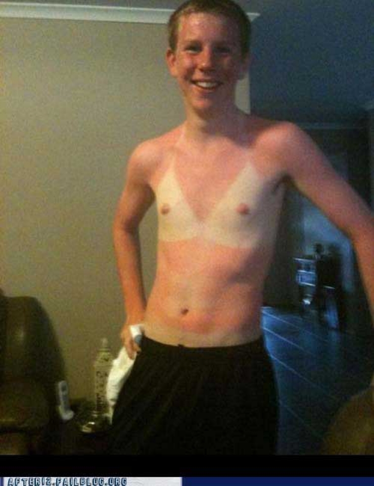 Illustration de l'article : The 24 most awkward tan lines this summer...