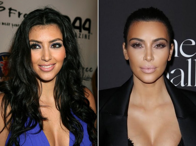 Illustration de l'article : The 16 most incredible changes experienced by celebrities in just 7 years