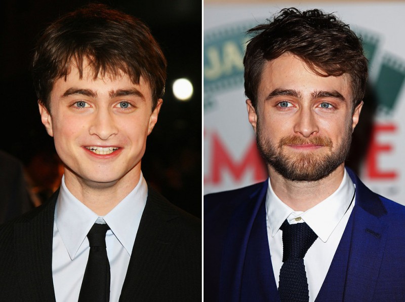 Illustration de l'article : The 16 most incredible changes experienced by celebrities in just 7 years