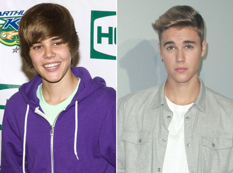 Illustration de l'article : The 16 most incredible changes experienced by celebrities in just 7 years