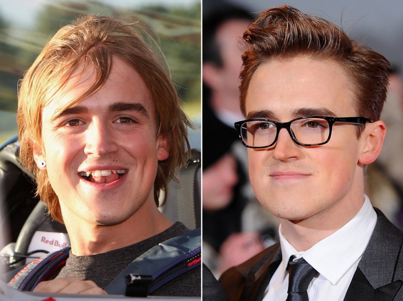 Illustration de l'article : The 16 most incredible changes experienced by celebrities in just 7 years