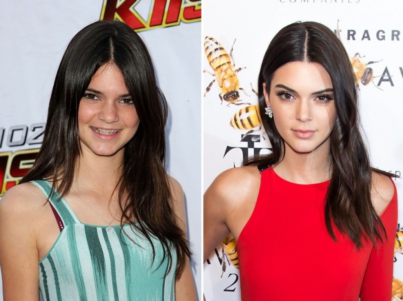 Illustration de l'article : The 16 most incredible changes experienced by celebrities in just 7 years