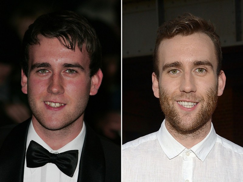 Illustration de l'article : The 16 most incredible changes experienced by celebrities in just 7 years