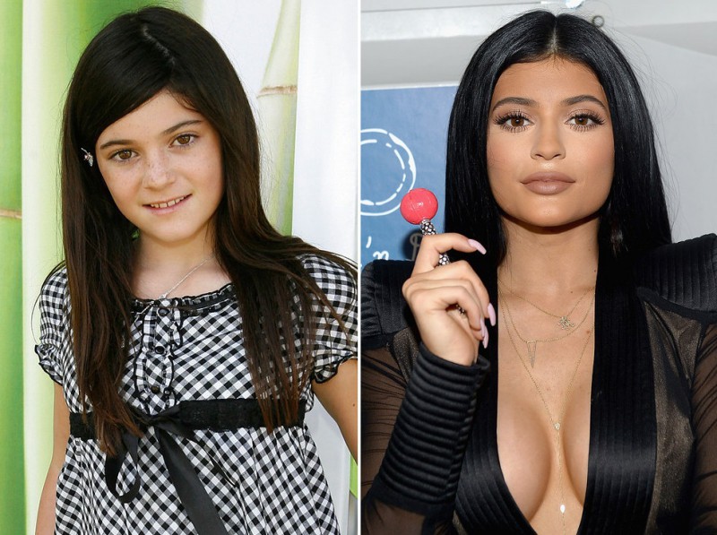 Illustration de l'article : The 16 most incredible changes experienced by celebrities in just 7 years