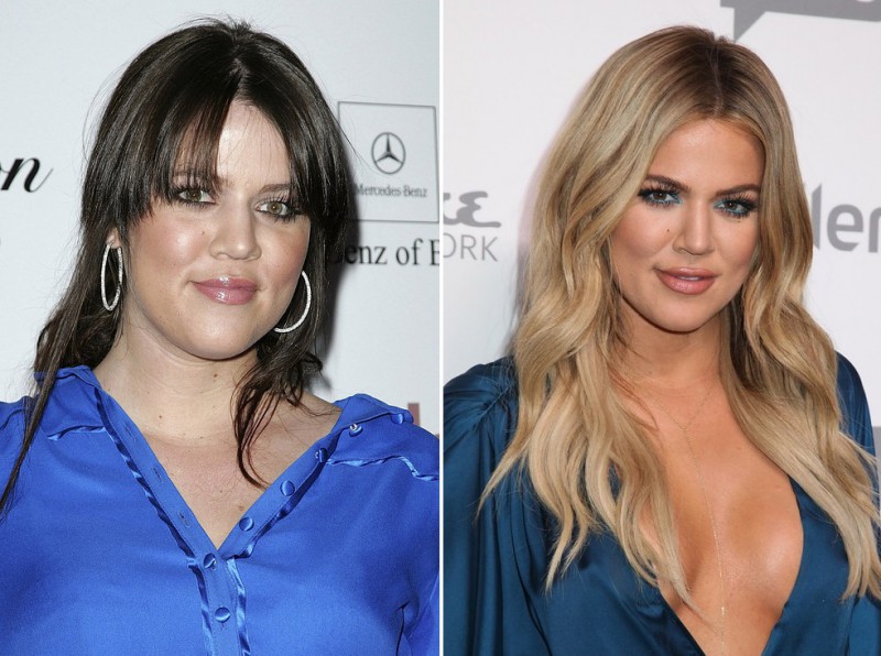 Illustration de l'article : The 16 most incredible changes experienced by celebrities in just 7 years