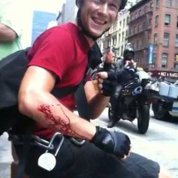 Illustration de l'article : 14 actors who suffered injuries during filming