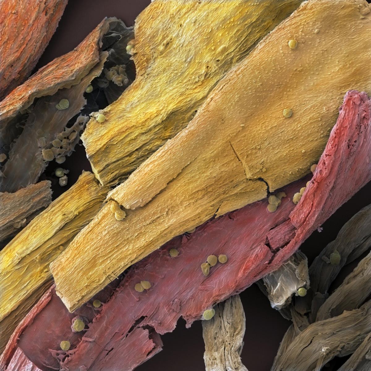 Illustration de l'article : 16 foods and beverages under the microscope!