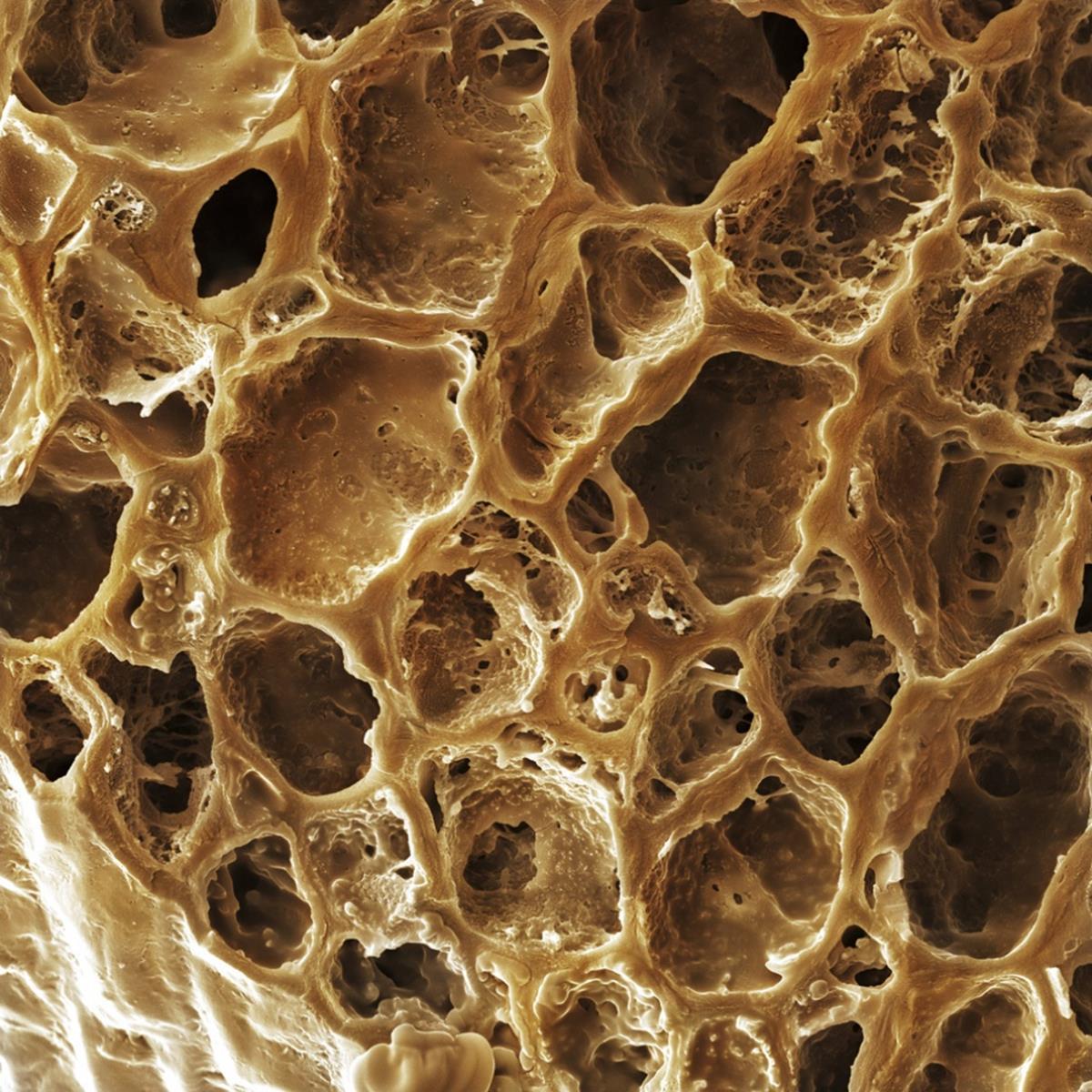 Illustration de l'article : 16 foods and beverages under the microscope!