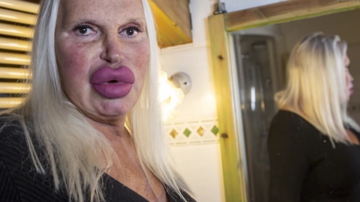 Illustration de l'article : This woman has spent ,000 to achieve the perfect look... What do you think, after seeing her before pictures?