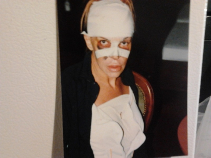 Illustration de l'article : This woman has spent ,000 to achieve the perfect look... What do you think, after seeing her before pictures?