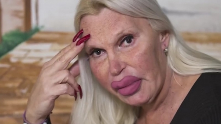 Illustration de l'article : This woman has spent ,000 to achieve the perfect look... What do you think, after seeing her before pictures?