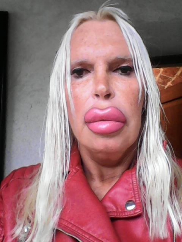 Illustration de l'article : This woman has spent ,000 to achieve the perfect look... What do you think, after seeing her before pictures?